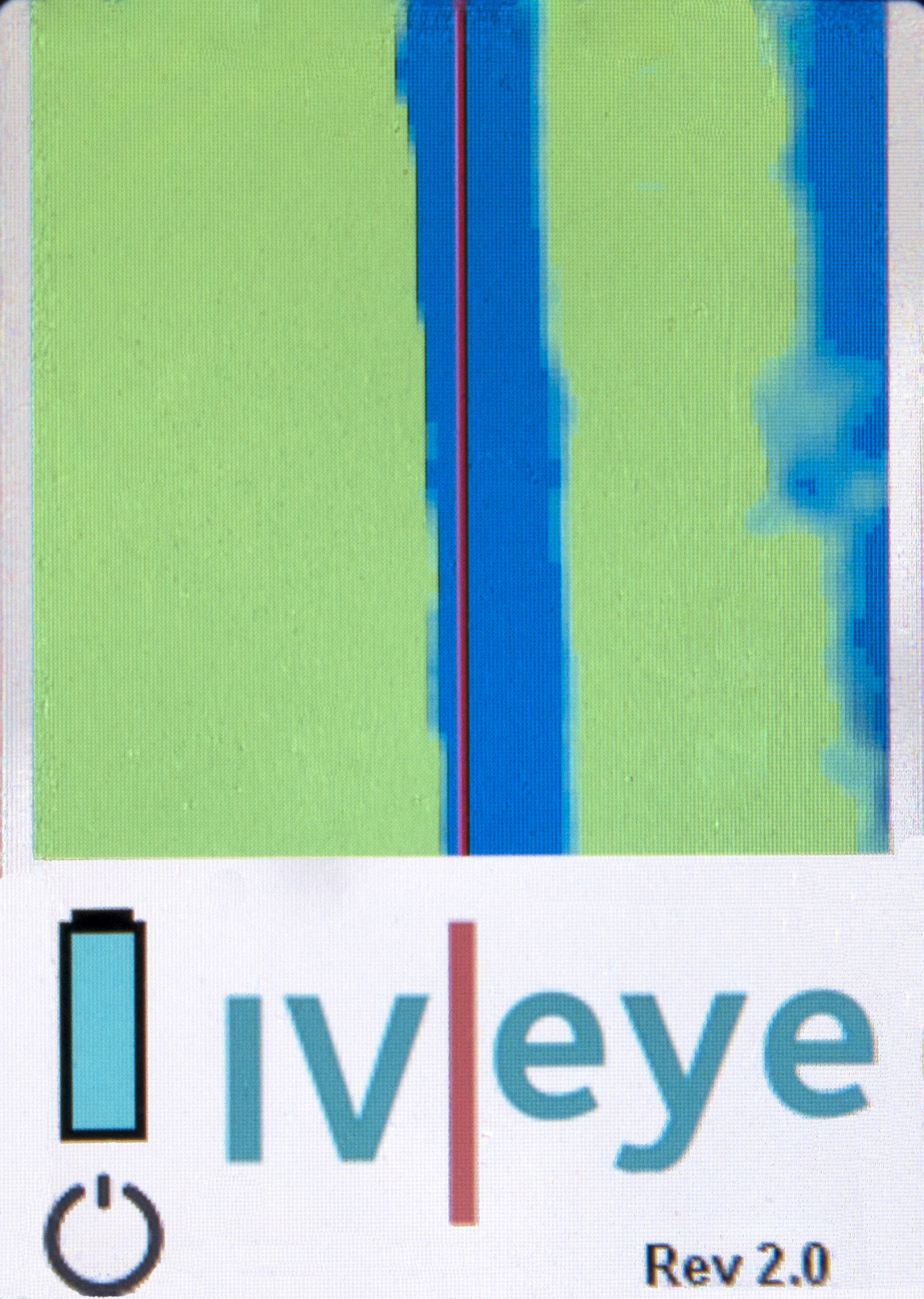 IV-eye device screen showing close-up color image of vein visualization